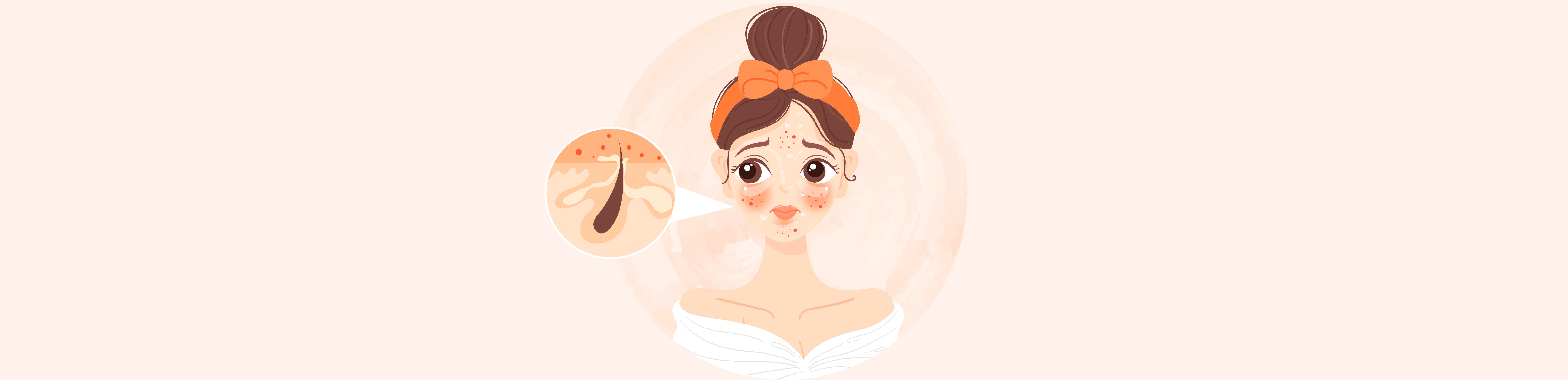 Does Sandalwood Powder Help Reduce Tanning and Pigmentation